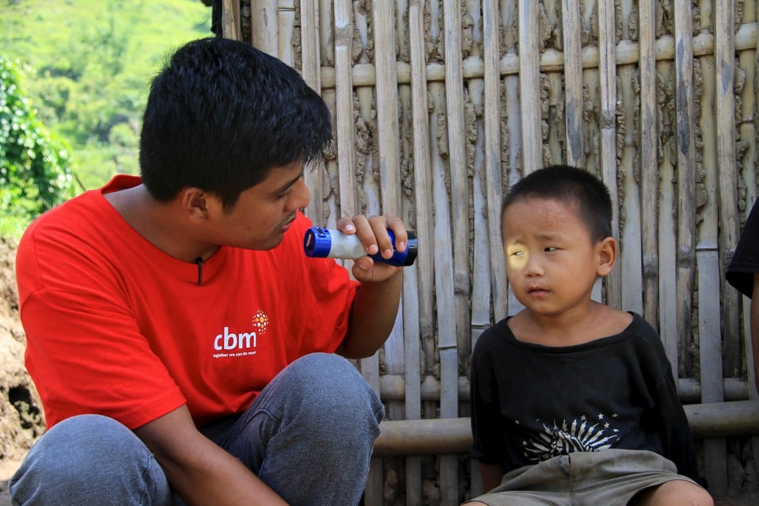 Fieldworker shines a light in Sudip's right eye