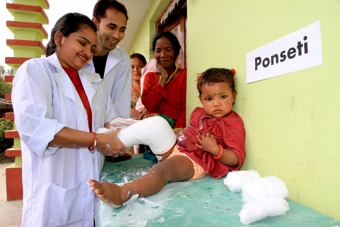 2 year old Archana receives treatment for clubfoot. 