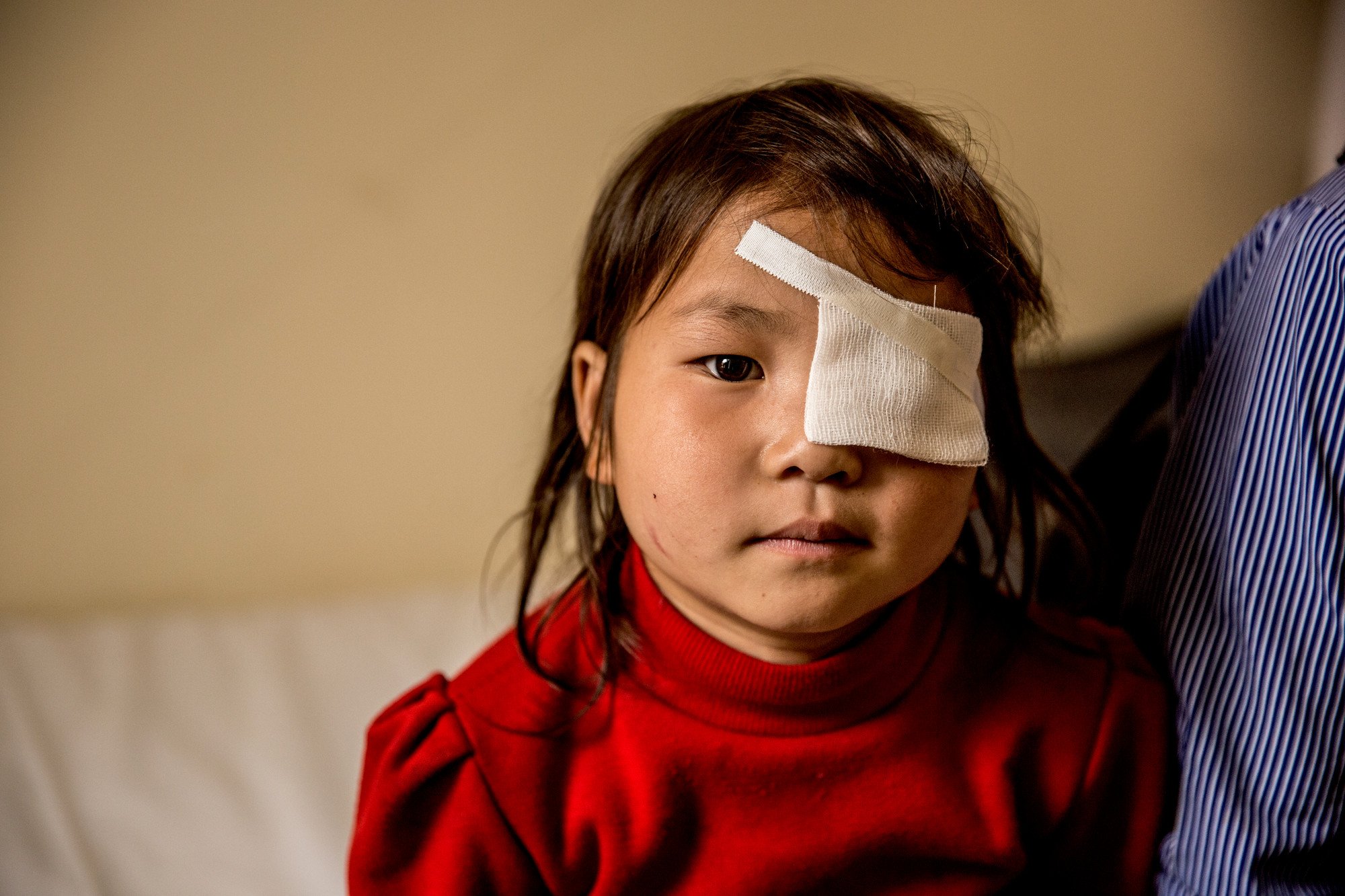 Close-up of Nhung looking to camera, with an eye patch over her left eye.