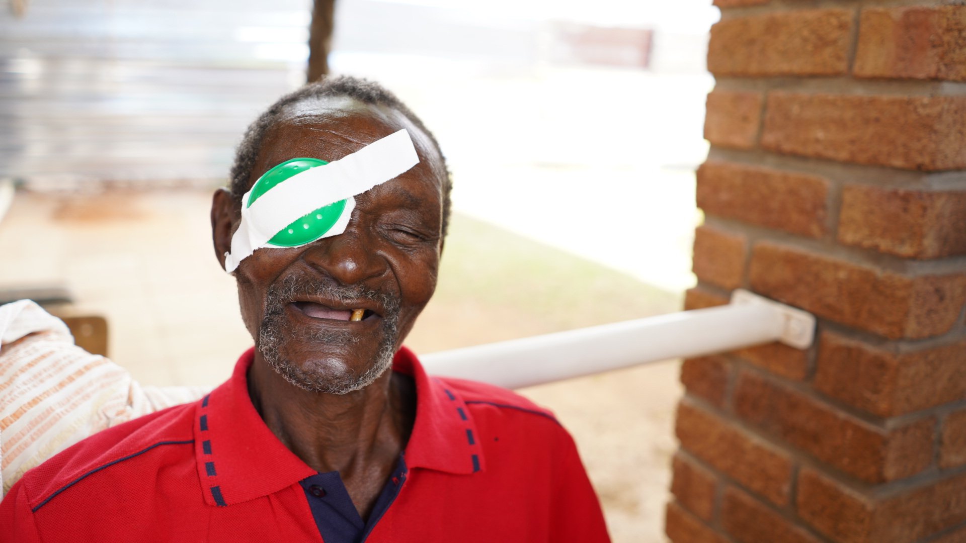 Paul from Zimbabwe, wearing an eye patch over his right eye and smiling.