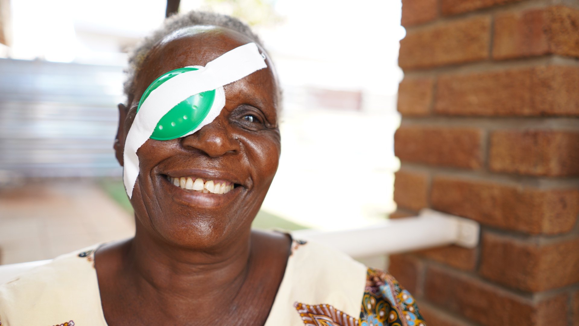 Mary from Zimbabwe, wearing an eye patch over her right eye and smiling.