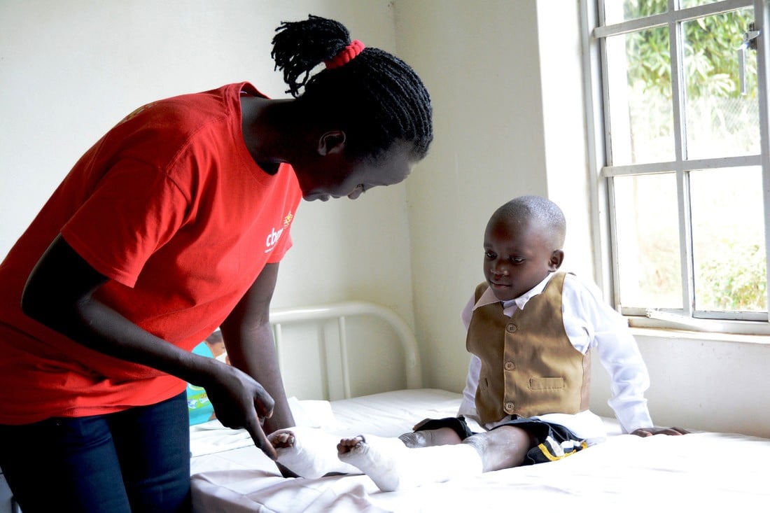 4 year old Sylas born with clubfoot undergoing treatment. Field worker Agnes Nabawanuka teaches some exercises.
