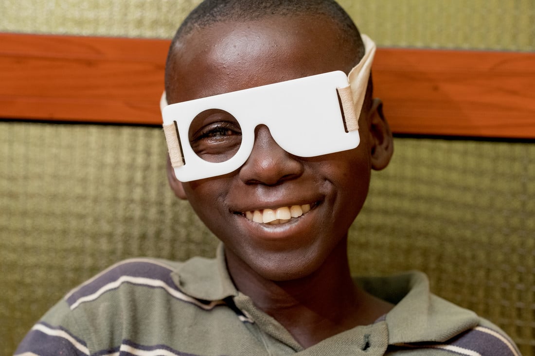 Teenage boy smiling with one eye covered.