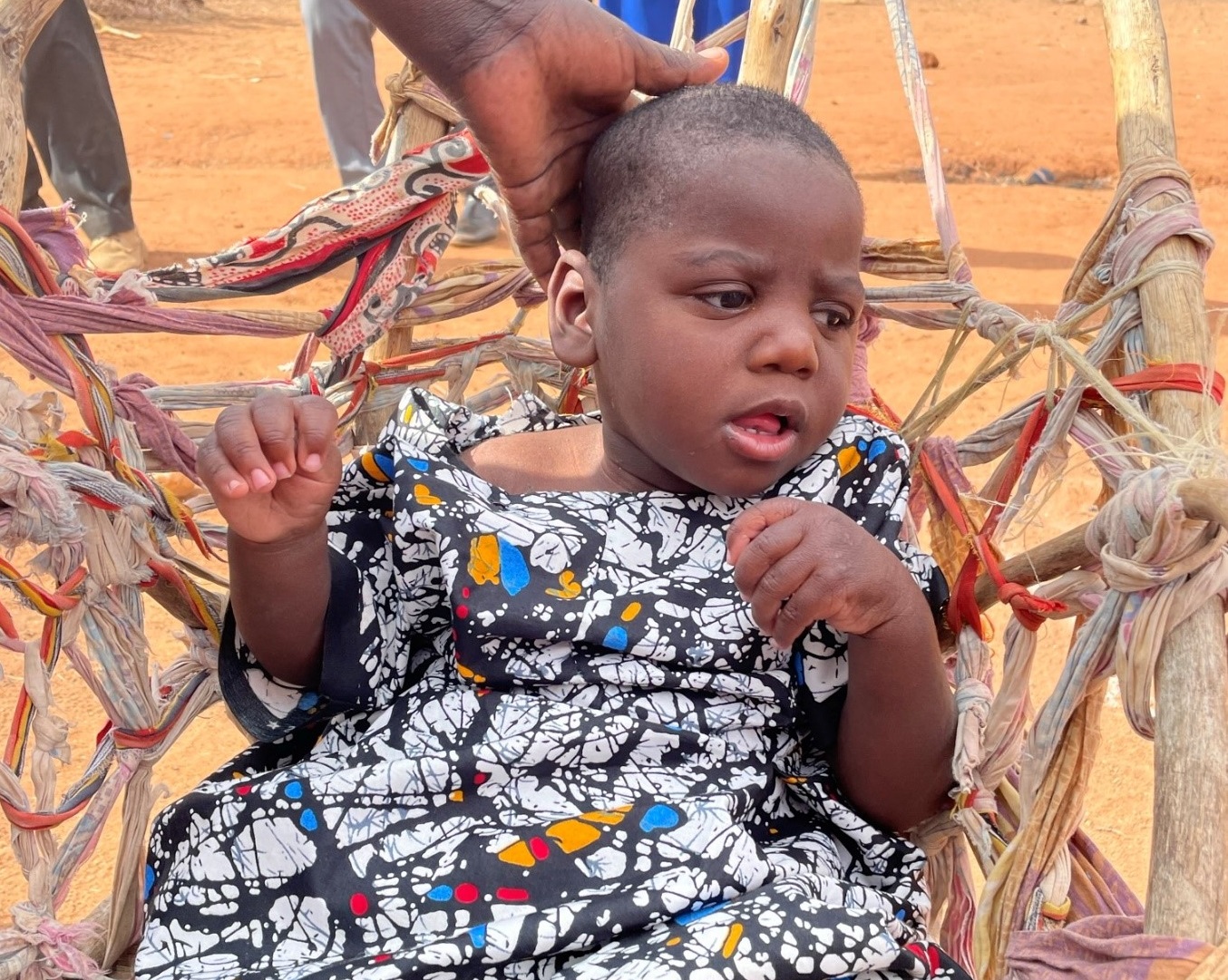 Winnyjoy, a 3 year old girl with cerebral palsy in an adapted chair made by her Dad, using fabric rags to provide support. 