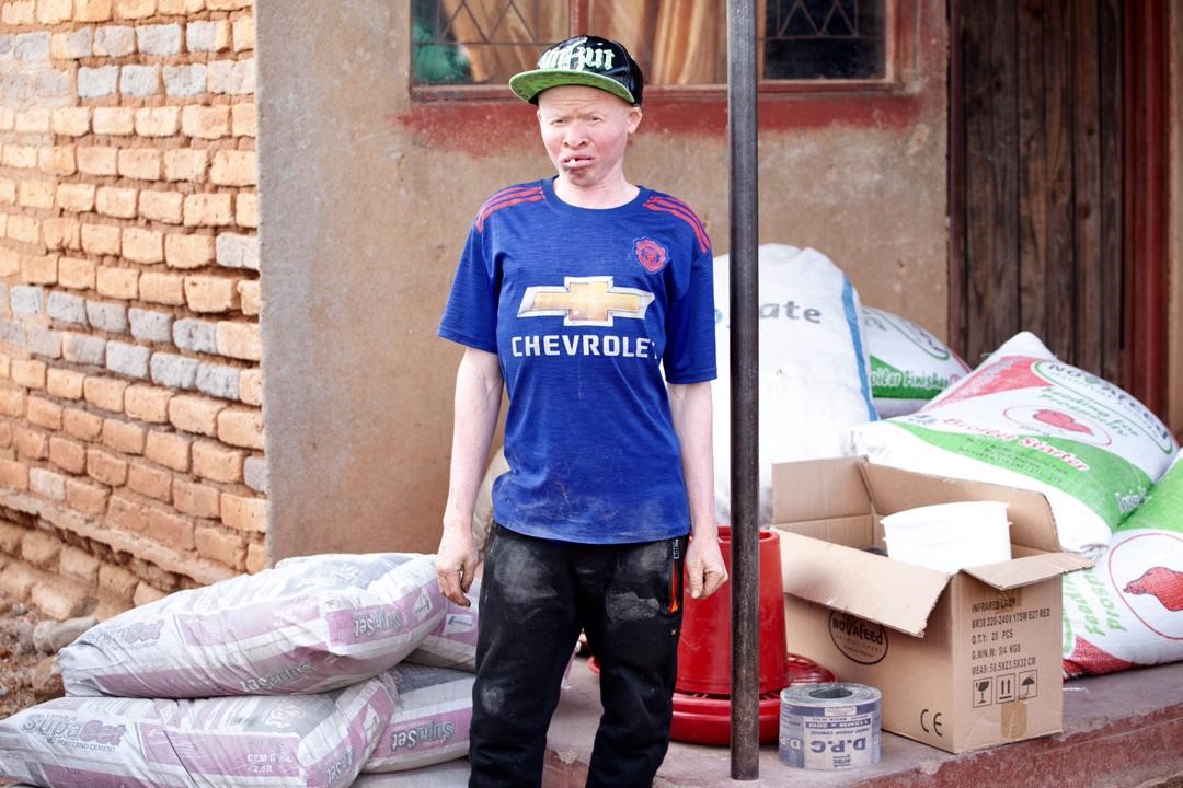 Youth with albinism with some of the materials to start up his business