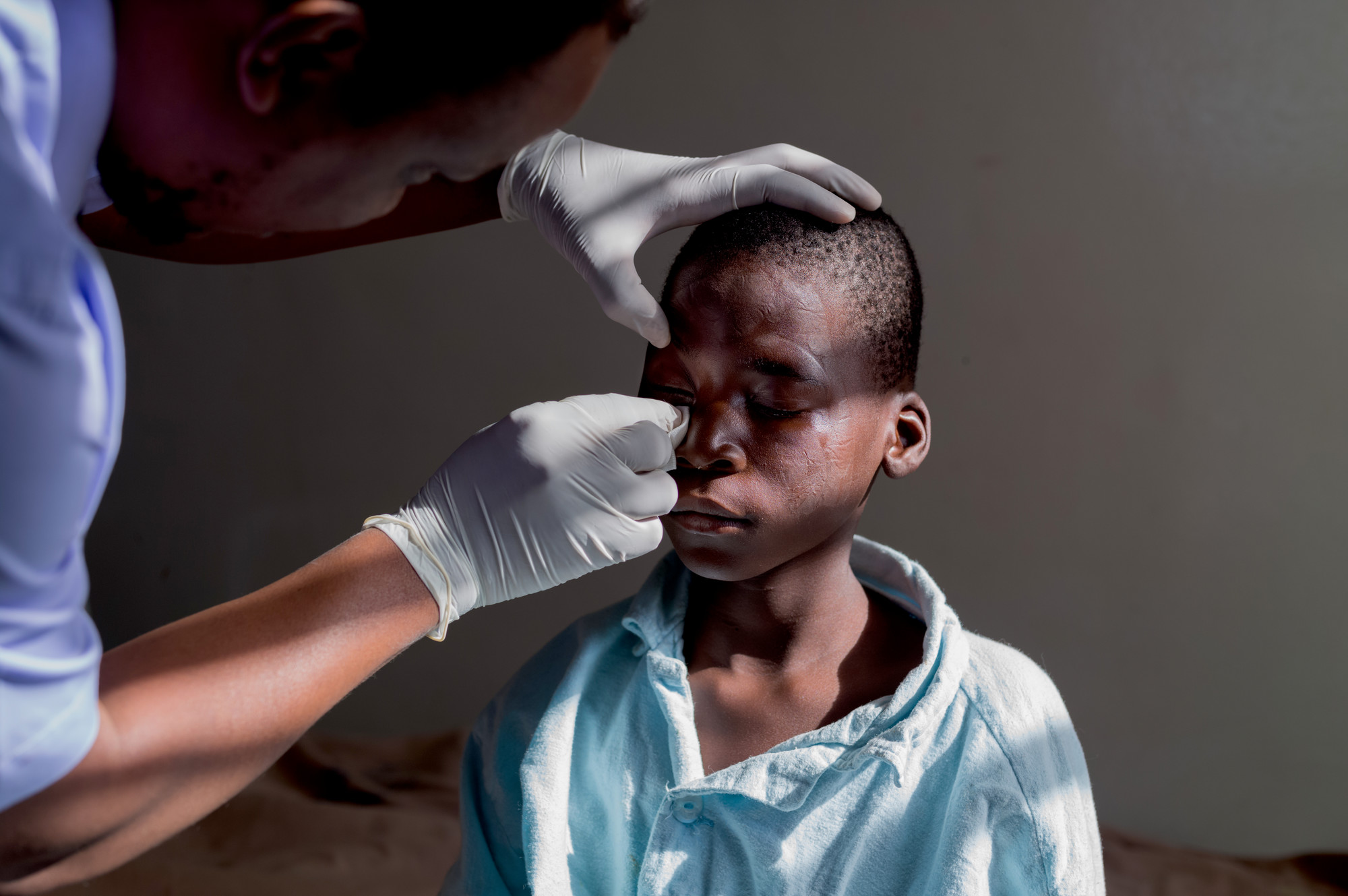 Dr Zimudzi removing an eye patch from a boy after successful cataract surgery