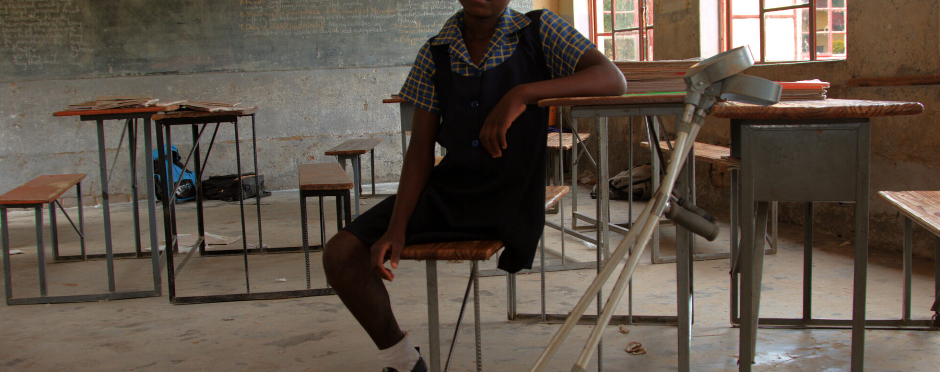 A girl with an amputated leg sits at a school desk in a classroom next to a pair of crutches.