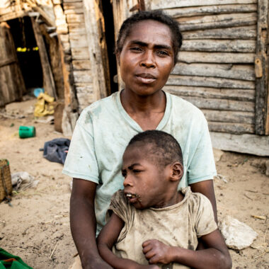 A mother holds her child with intellectual disabilities in her lap.