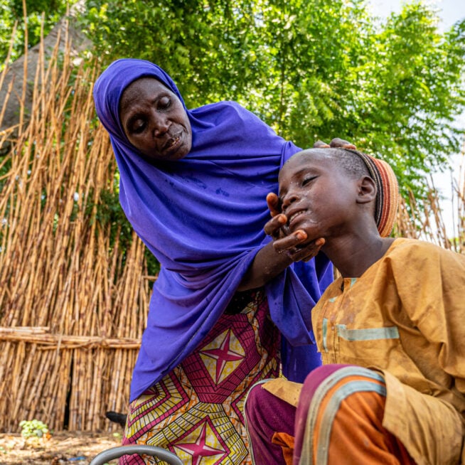 A woman, wearing a blue headscarf, bends over to wash the face of a boy sufering from an NTD .