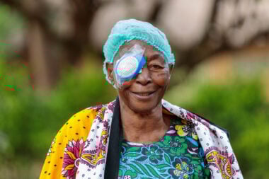 Juliana wears a patch over her right eye following cataract surgery.
