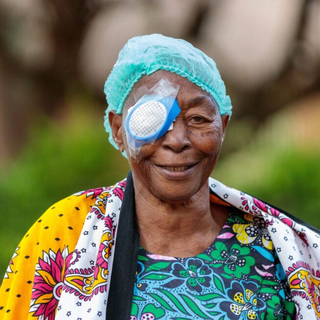 Juliana wears a patch over her right eye following cataract surgery.