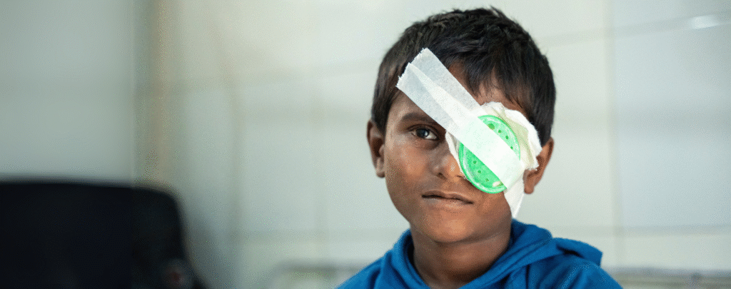 A young boy from Nepal, who was living with avoidable blindness, smiling with an eye patch on after cataract surgery.