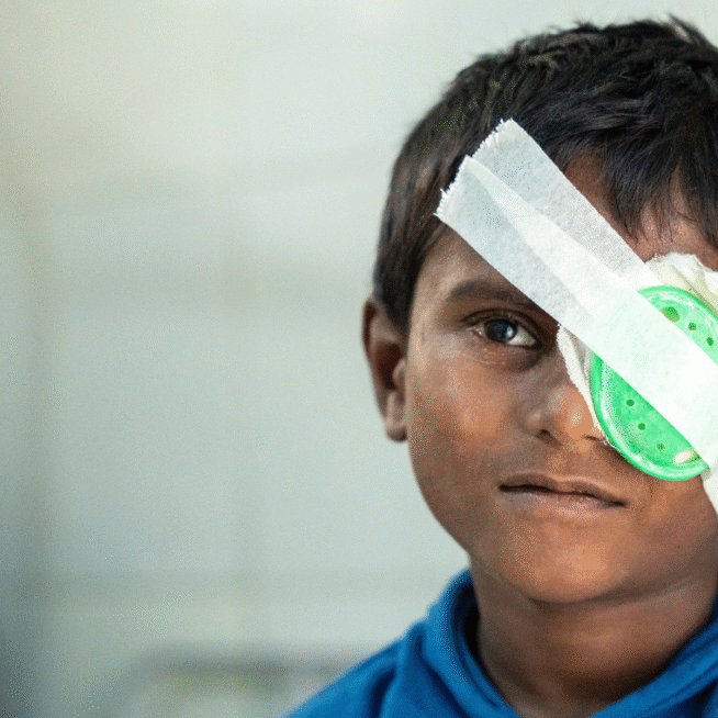 A young boy from Nepal, who was living with avoidable blindness, smiling with an eye patch on after cataract surgery.