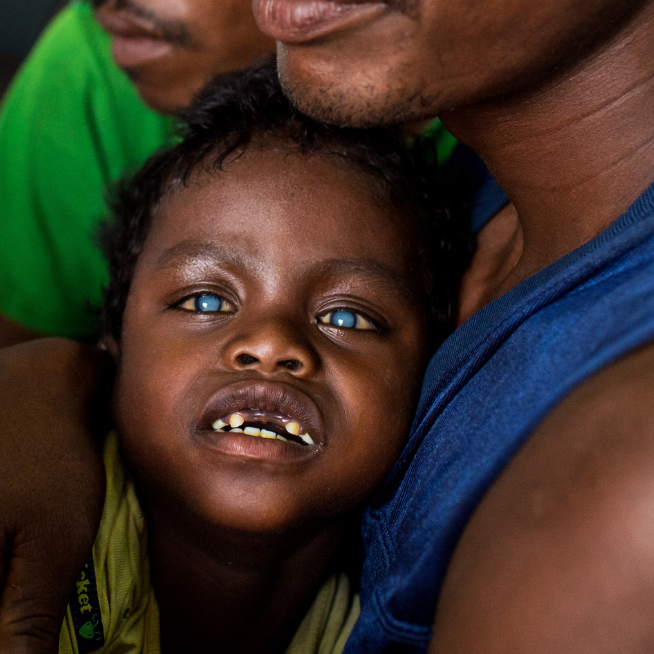 A little boy with dark brown hair leans against his fathers chest. His eyes are blue and cloudy, showing clearly the bilateral cataracts.