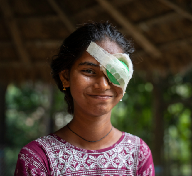 A girl wearing a pink and white patterned dress is sat outside under a hut smiling into the camera. She has dark hair pulled back, and has a green eye patch on her left eye.