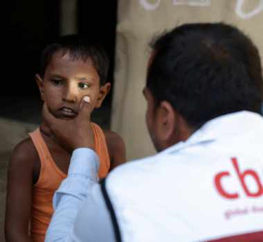 Anshu has his left eye examined by a man in a CBM jacket. With a donation this Christmas CBM UK can reach more children at risk of losing their eyesight.